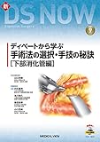 ディベートから学ぶ 手術法の選択・手技の秘訣［下部消化管編］［Web動画付］ (新DS NOW 9)