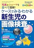 ケースでみる・わかる 新生児の画像検査: 写真&シェーマを並べて理解! (ネオネイタルケア2016年春季増刊)