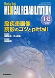 脳疾患画像読影のコツとpitfall (MB MEDICAL REHABILITATION)